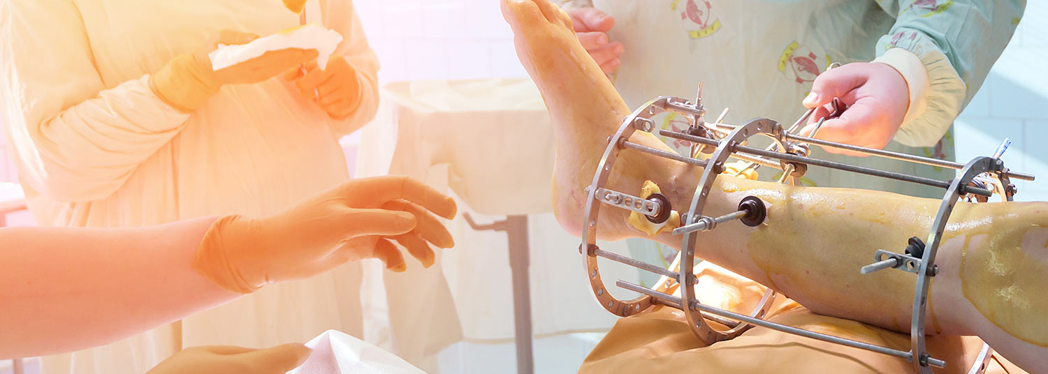 Leg Fracture Surgery banner