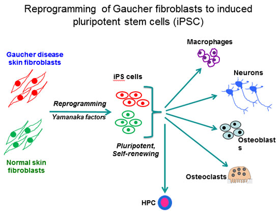 Reprogramming of Gaucher fibroblasts to induced pluripotent stem cells