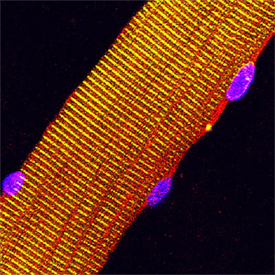 Staining of mouse muscle fibers shows that three proteins that regulate calcium levels are assembled into a single three-part complex, visible as yellow. (green = small ankryin 1 and sarcolipin within 