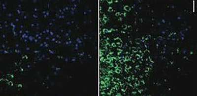 Cells in the hypothalamus of a mouse make more of the inflammation protein IKK2 (green) when the mice breath polluted air (right) compared to filtered air (left). Credit: Ying Laboratory