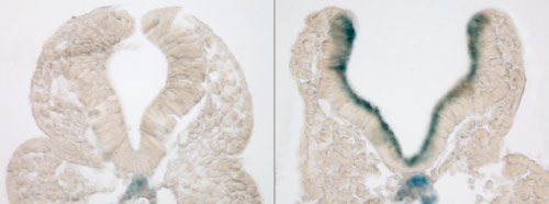 Markers of premature aging (blue) are found in the neural tubes of mouse embryos from mothers with diabetes (right), and not in embryos from healthy mothers (left). Credit: Peixin Yang