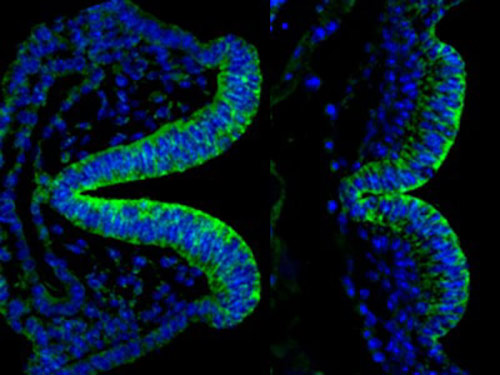 Neural tube of a mouse embryo from a mother with diabetes at 8 (left) and 8.5 (right) days old with marker of premature aging (green). Credit: Peixin Yang