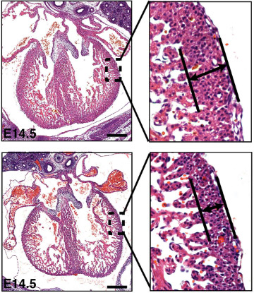 When the cells lining the heart are missing HDAC3 (bottom), then the mouse heart develops thinner, compact walls in the ventricle compared to normal mouse hearts (top). Credit: Circulation Research