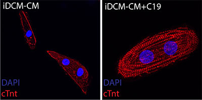 Heart muscle cells with mutations in the gene that makes the Rotatin protein that are treated with the small molecule C19 (right) show improved muscle fiber organization (red) when compared to untreated heart muscle cells (left). Credit: Matthew Miyamoto.