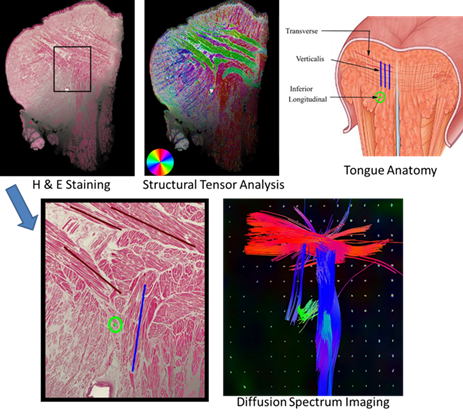 Diffusion tractography and histology verification in the tongue