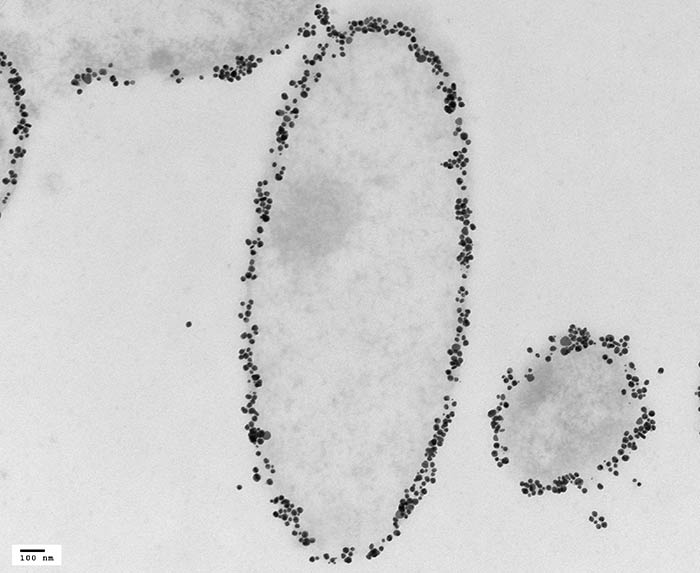 IEM - Phage infected Bacteria, labeled with enhanced 10nm gold