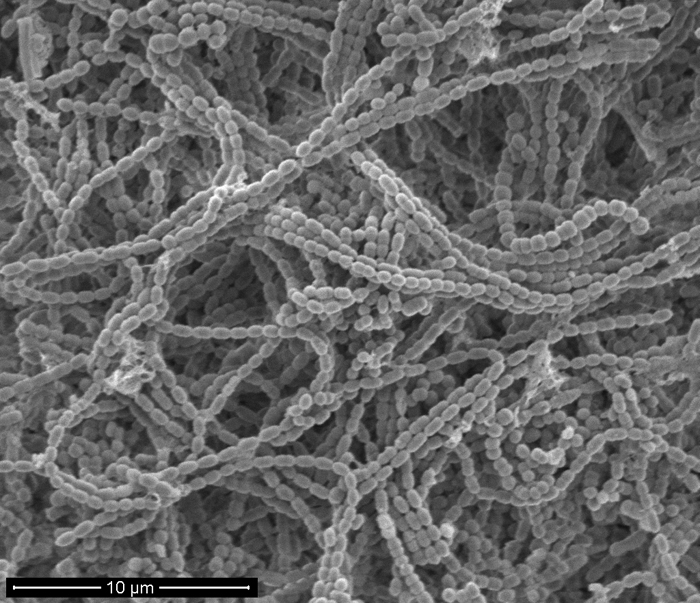 SEM - Bacterial Chains