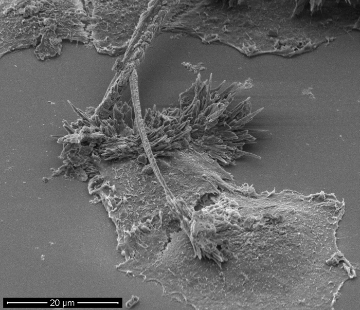 SEM - Chemically Induced Transformation of HeLa Cells