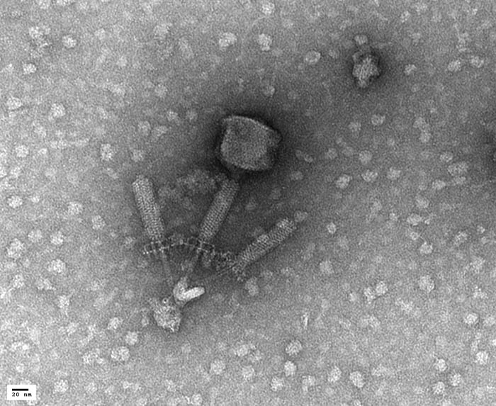 TEM - Mutant Bacterial Phage