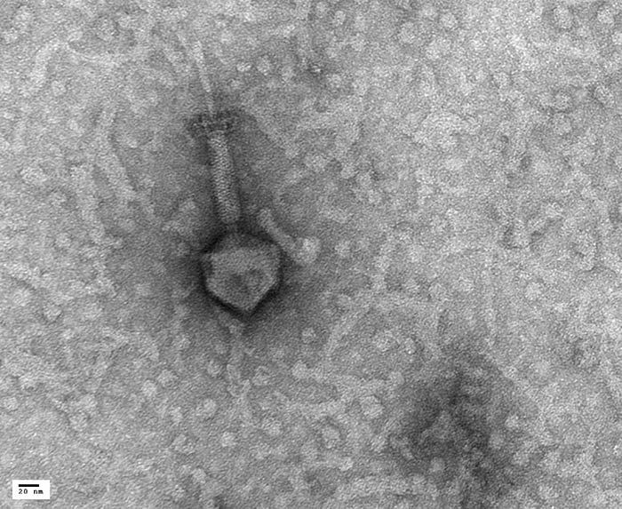 TEM - Bacterial Phage