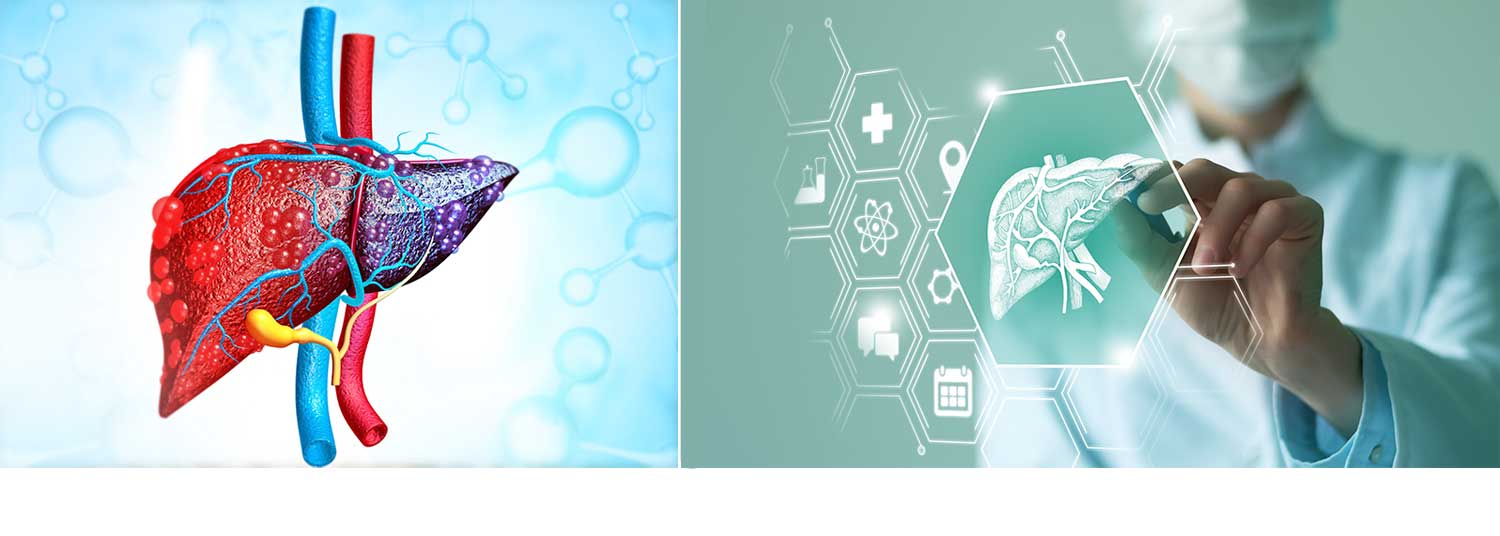 Liver Cancer Therapies banner
