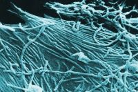 colorized em of Ebola virus