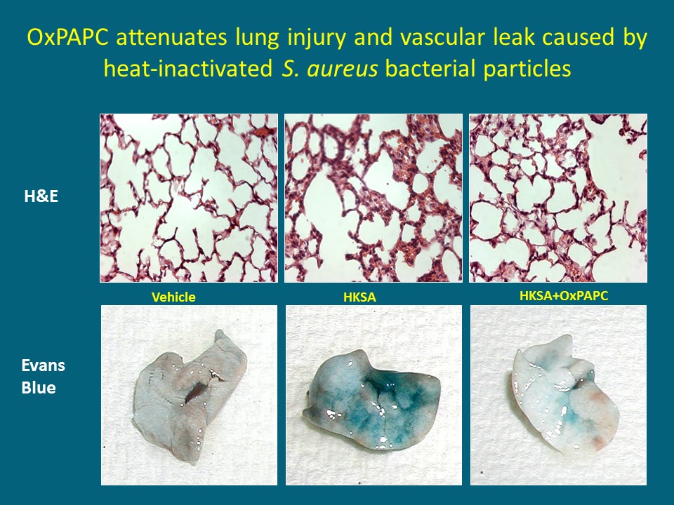 Figure 2: Barrier-protective oxidized phospholipids attenuate septic lung inflammation and pulmonary edema