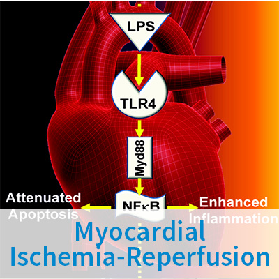 Myocardial Ischemia-Reperfusion