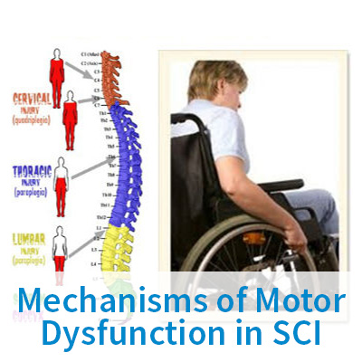 Mechanisms of Motor Dysfunction in SCI
