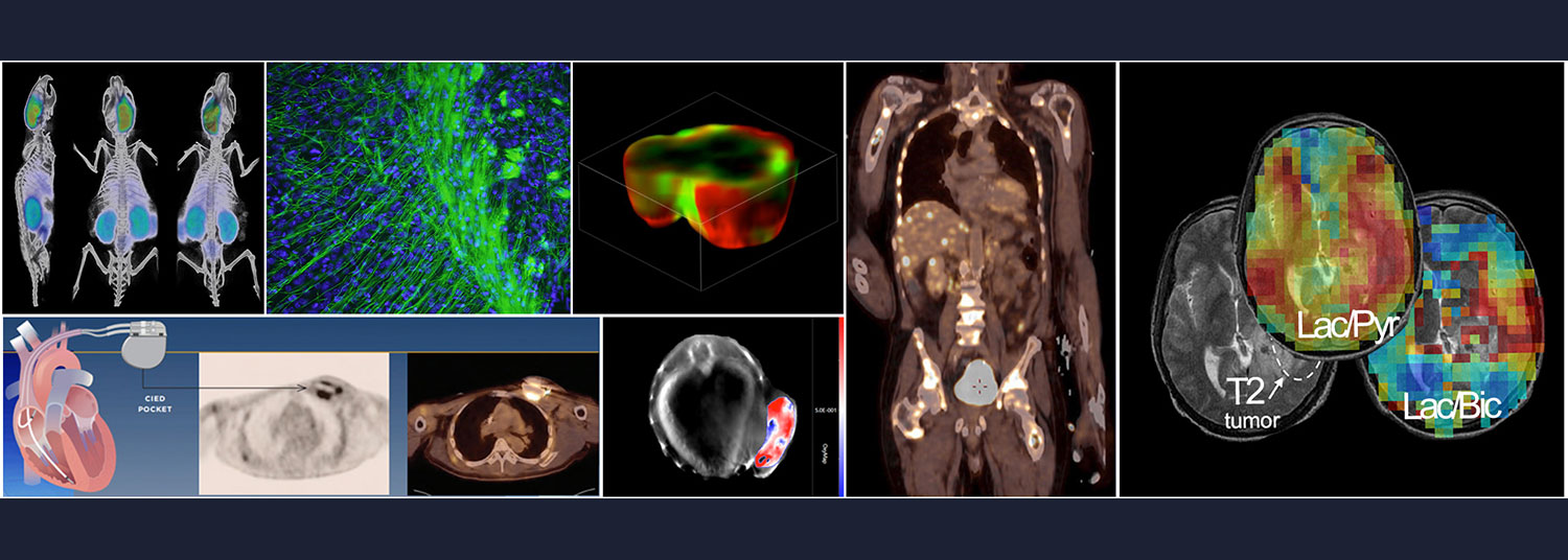 Alavi-Bradley Symposium