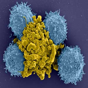 CD4 T cells (blue) interacting with an activated dendritic cell (yellow). Image courtesy of Kaveh Abdi(NIH) and Nevil Singh (UMSOM).