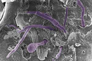 Microbial Pathogenesis