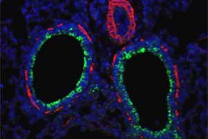 Virus Under Microscope