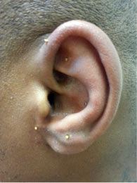 ear