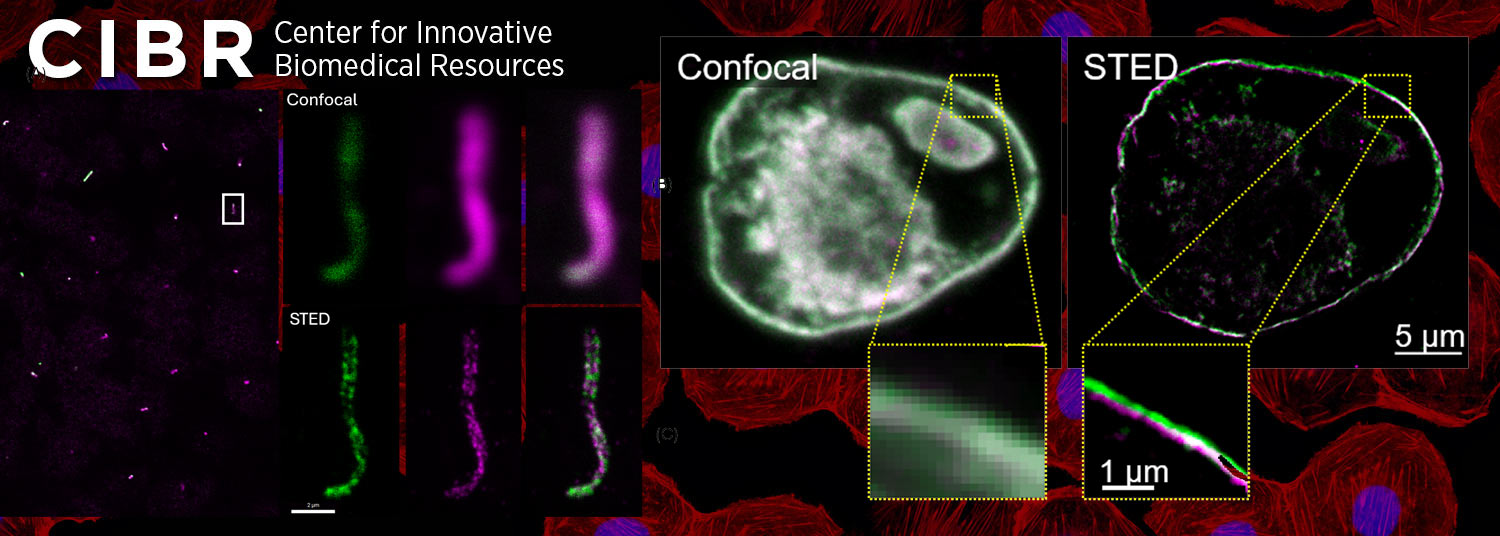 Confocal Banner