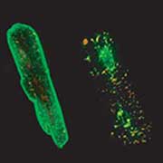 Cardiomyocyte MA Cell