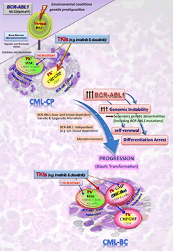 Environmental conditions genetic predisposition