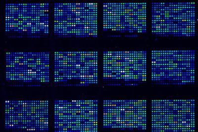 DNA Microarray