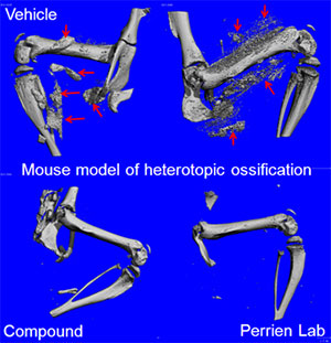Mouse model of heterotopic ossification