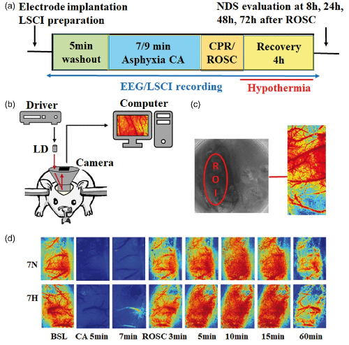 Diagram of laser speckle contrast imaging