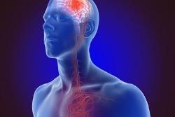 Brain injury illustration