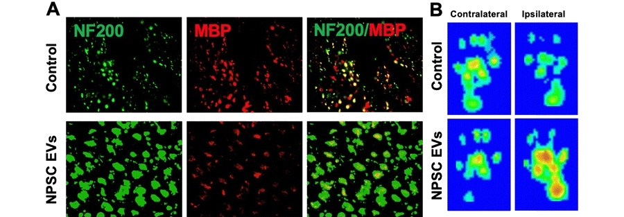 Differentiation state and culture conditions impact neural stem/progenitor cell-derived extracellular vesicle bioactivity.