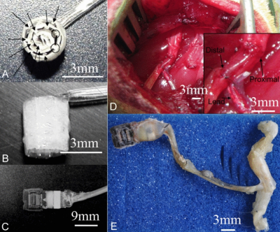 Biodegradable Regenerative Neural Interfaces for Peripheral Nerves