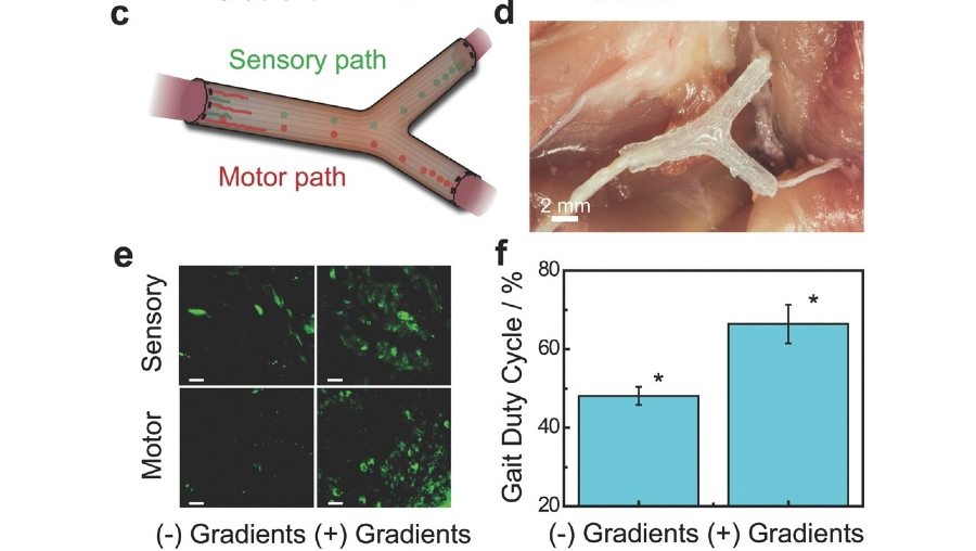 Personalized 3D‑Printed Nerve Guides for Complex Peripheral Nerve Regeneration