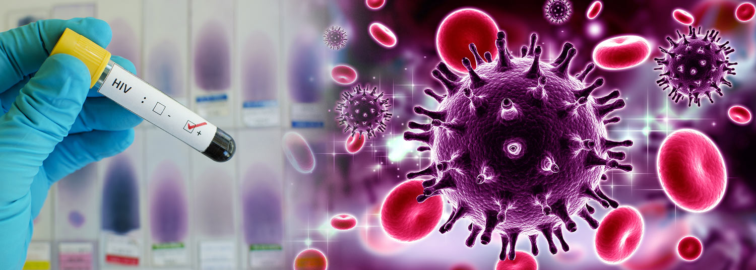 Vile labeled HIV next to the HIV virus seen in a microscope