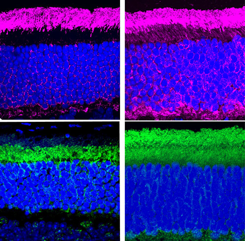 In eye tissue from an Usher syndrome mouse model (right), the light-dark cycle proteins (purple and green) are spread throughout the two photoreceptor compartments rather than separated in one or the other as in the healthy mouse eye tissue (left).