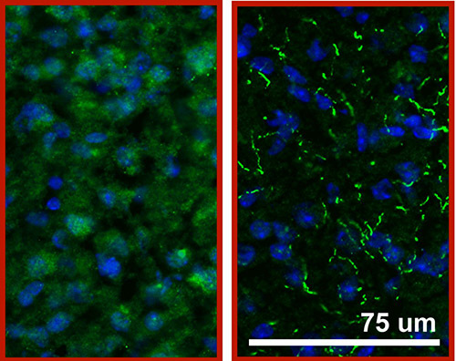 PDE11 (green) in the brains of two different mouse strains. In one strain the PDE11 is diffuse and the other it is bunched. Credit: Michy Kelly