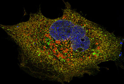 SARS-COV-2 Orf6 protein (red) in a mammalian cell. Credit: Dr. Zhe Han