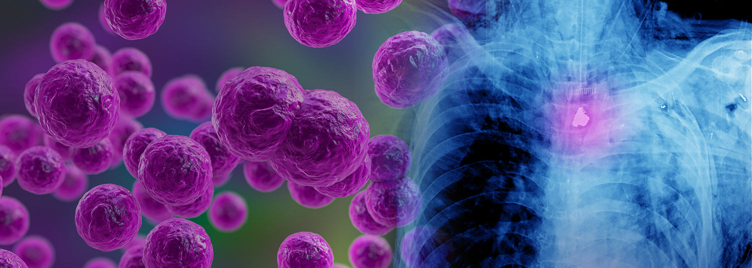 Bacteria firearm story banner