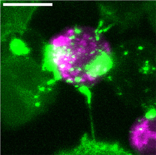 This is a lattice light sheet microscopy image of a CAR T cell (purple cell in the middle), ripping fragments off the surrounding tumor cells (green cells). The image was created by Kiet Nguyen, Elizabeth Anne Kiely, and Dr. Arpita Upadhyaya.