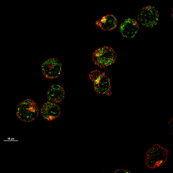 Maturing precursor red blood cells display Heme Responsive Gene 1(HRG1) transporters (in green). These transporters, expressed on cell membranes, shuttle heme into the interior of the cell to make hemoglobin.
