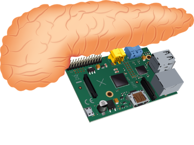 illustration of a pancreas above a computer chip board