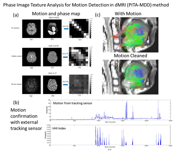 Phase Image Texture Analysis