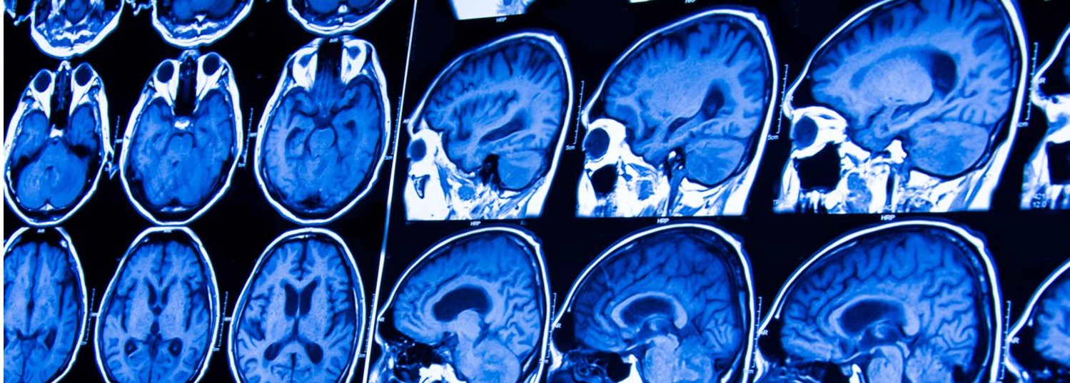 Brain Imaging Banner 1