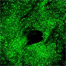 AAV Transduction in Mouse Brain