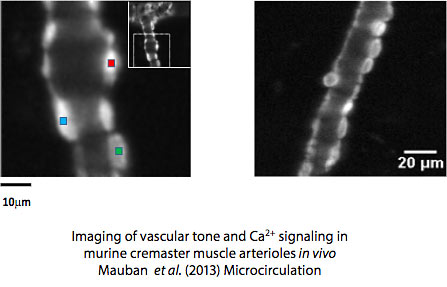 Vascular Tone Image