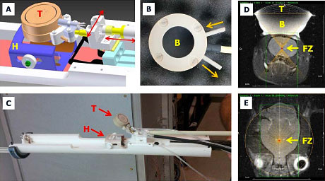 MRI Guided Ultrasound Steps