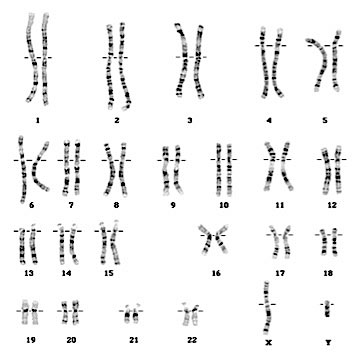 Chromosome