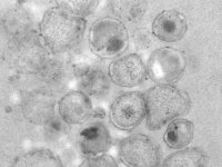 Immunogold labeling of specimen prepared by cryo EM sample preparation method