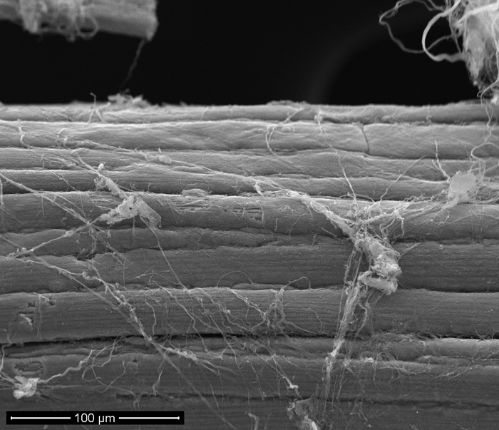 SEM - Skeletal Muscle